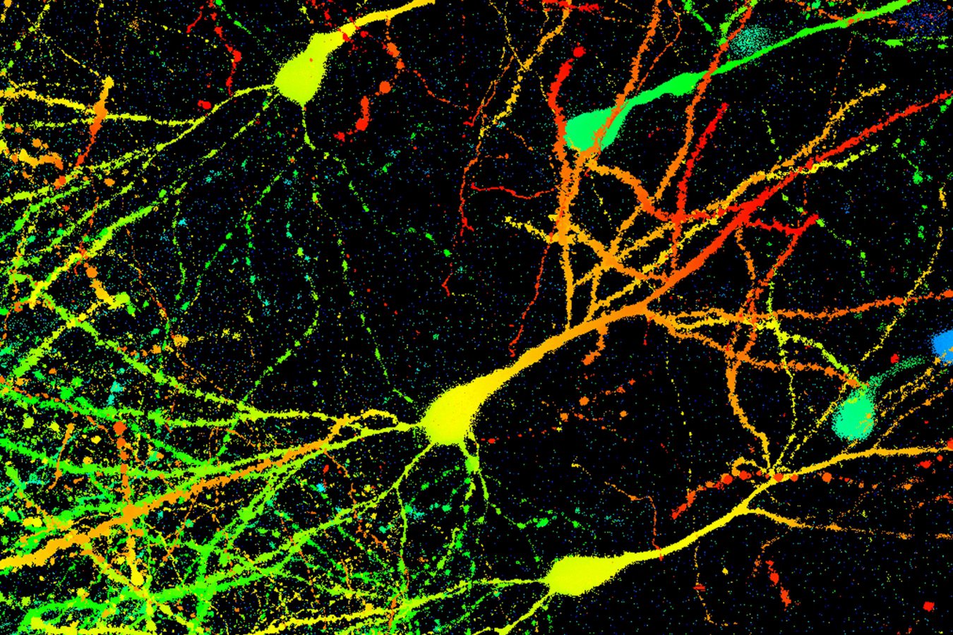 New Study Challenges Prevailing Theories on Memory Retention